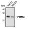 Proteasome Subunit Alpha 5 antibody, PA5-17306, Invitrogen Antibodies, Western Blot image 