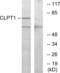 CLPTM1 Regulator Of GABA Type A Receptor Forward Trafficking antibody, abx015226, Abbexa, Western Blot image 