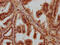Pyrophosphatase (Inorganic) 2 antibody, CSB-PA867137LA01HU, Cusabio, Immunohistochemistry paraffin image 