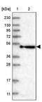 Kelch Repeat And BTB Domain Containing 4 antibody, PA5-58109, Invitrogen Antibodies, Western Blot image 