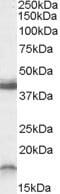 Receptor Activity Modifying Protein 1 antibody, NBP1-20966, Novus Biologicals, Western Blot image 