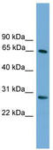 F-box/WD repeat-containing protein 8 antibody, TA330940, Origene, Western Blot image 