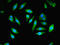 Peroxisomal Biogenesis Factor 11 Beta antibody, LS-C376302, Lifespan Biosciences, Immunofluorescence image 