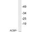 Diazepam Binding Inhibitor, Acyl-CoA Binding Protein antibody, LS-C291659, Lifespan Biosciences, Western Blot image 