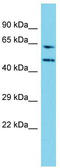 Diphthamide Biosynthesis 7 antibody, TA333533, Origene, Western Blot image 