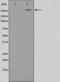 Acetyl-CoA Carboxylase Alpha antibody, GTX52340, GeneTex, Western Blot image 