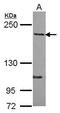 Rho GTPase Activating Protein 5 antibody, GTX119041, GeneTex, Western Blot image 