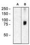 Rho Guanine Nucleotide Exchange Factor 4 antibody, NBP2-62217, Novus Biologicals, Western Blot image 