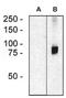 Rho guanine nucleotide exchange factor 4 antibody, NBP2-62217, Novus Biologicals, Western Blot image 