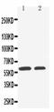 Solute Carrier Family 22 Member 1 antibody, PA5-80014, Invitrogen Antibodies, Western Blot image 
