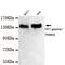 Tripartite Motif Containing 33 antibody, GTX49184, GeneTex, Western Blot image 