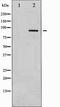 Protein Kinase C Alpha antibody, TA327852, Origene, Western Blot image 