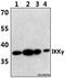 Inhibitor Of Nuclear Factor Kappa B Kinase Regulatory Subunit Gamma antibody, A00874-3, Boster Biological Technology, Western Blot image 