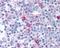Signal Transducer And Activator Of Transcription 2 antibody, 48-800, ProSci, Immunohistochemistry paraffin image 