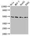 TEA Domain Transcription Factor 4 antibody, CSB-PA618010LA01HU, Cusabio, Western Blot image 