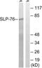 Lymphocyte Cytosolic Protein 2 antibody, LS-C118332, Lifespan Biosciences, Western Blot image 