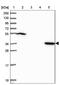 Phospholipid Phosphatase Related 2 antibody, NBP2-14253, Novus Biologicals, Western Blot image 