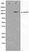 SUMO Specific Peptidase 7 antibody, TA347494, Origene, Western Blot image 