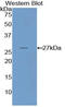 Nicotinamide N-Methyltransferase antibody, MBS2001416, MyBioSource, Western Blot image 