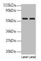 Inosine Monophosphate Dehydrogenase 2 antibody, CSB-PA01195A0Rb, Cusabio, Western Blot image 