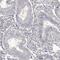 RBMX Like 2 antibody, PA5-58588, Invitrogen Antibodies, Immunohistochemistry frozen image 