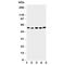 Abl Interactor 2 antibody, R31179, NSJ Bioreagents, Western Blot image 