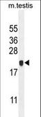 Chromosome 4 Open Reading Frame 46 antibody, LS-C168148, Lifespan Biosciences, Western Blot image 