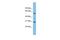 Dihydrouridine Synthase 1 Like antibody, GTX44886, GeneTex, Western Blot image 