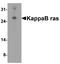 NFKB Inhibitor Interacting Ras Like 1 antibody, A11990, Boster Biological Technology, Western Blot image 