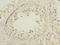 DnaJ Heat Shock Protein Family (Hsp40) Member B1 antibody, LS-C211699, Lifespan Biosciences, Immunohistochemistry paraffin image 
