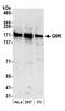 SIK Family Kinase 3 antibody, A302-455A, Bethyl Labs, Western Blot image 