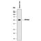 Cytochrome P450 Family 3 Subfamily A Member 4 antibody, MAB9079, R&D Systems, Western Blot image 