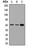 TCP-1 antibody, LS-C668884, Lifespan Biosciences, Western Blot image 