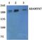 ADAM Metallopeptidase With Thrombospondin Type 1 Motif 7 antibody, A07001, Boster Biological Technology, Western Blot image 