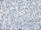 Polo Like Kinase 1 antibody, LS-C784218, Lifespan Biosciences, Immunohistochemistry frozen image 