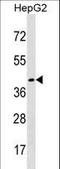 Desert Hedgehog Signaling Molecule antibody, LS-C159454, Lifespan Biosciences, Western Blot image 