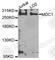 Mediator Of DNA Damage Checkpoint 1 antibody, A8358, ABclonal Technology, Western Blot image 