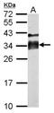 Acrosomal Vesicle Protein 1 antibody, NBP2-16979, Novus Biologicals, Western Blot image 