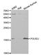 RNA Polymerase II Subunit J antibody, A1843, ABclonal Technology, Western Blot image 