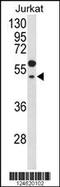 G Protein Subunit Alpha Transducin 1 antibody, 64-112, ProSci, Western Blot image 