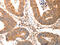 C-C Motif Chemokine Ligand 17 antibody, CSB-PA174494, Cusabio, Immunohistochemistry paraffin image 