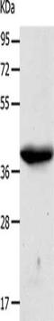 Cyclin Dependent Kinase 7 antibody, CSB-PA440881, Cusabio, Western Blot image 
