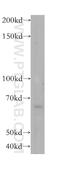 Methionyl Aminopeptidase 2 antibody, 17040-1-AP, Proteintech Group, Western Blot image 