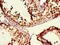 MutS Homolog 4 antibody, LS-C395997, Lifespan Biosciences, Immunohistochemistry paraffin image 
