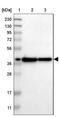 Testis Expressed 264, ER-Phagy Receptor antibody, NBP1-89866, Novus Biologicals, Western Blot image 