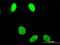 OTU Deubiquitinase 7B antibody, H00056957-M01, Novus Biologicals, Immunocytochemistry image 