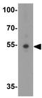 Thyroid Hormone Receptor Interactor 6 antibody, GTX31421, GeneTex, Western Blot image 
