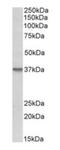 Syndecan 1 antibody, orb176733, Biorbyt, Western Blot image 