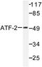 Activating Transcription Factor 2 antibody, LS-C175926, Lifespan Biosciences, Western Blot image 