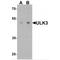 Unc-51 Like Kinase 3 antibody, MBS153614, MyBioSource, Western Blot image 